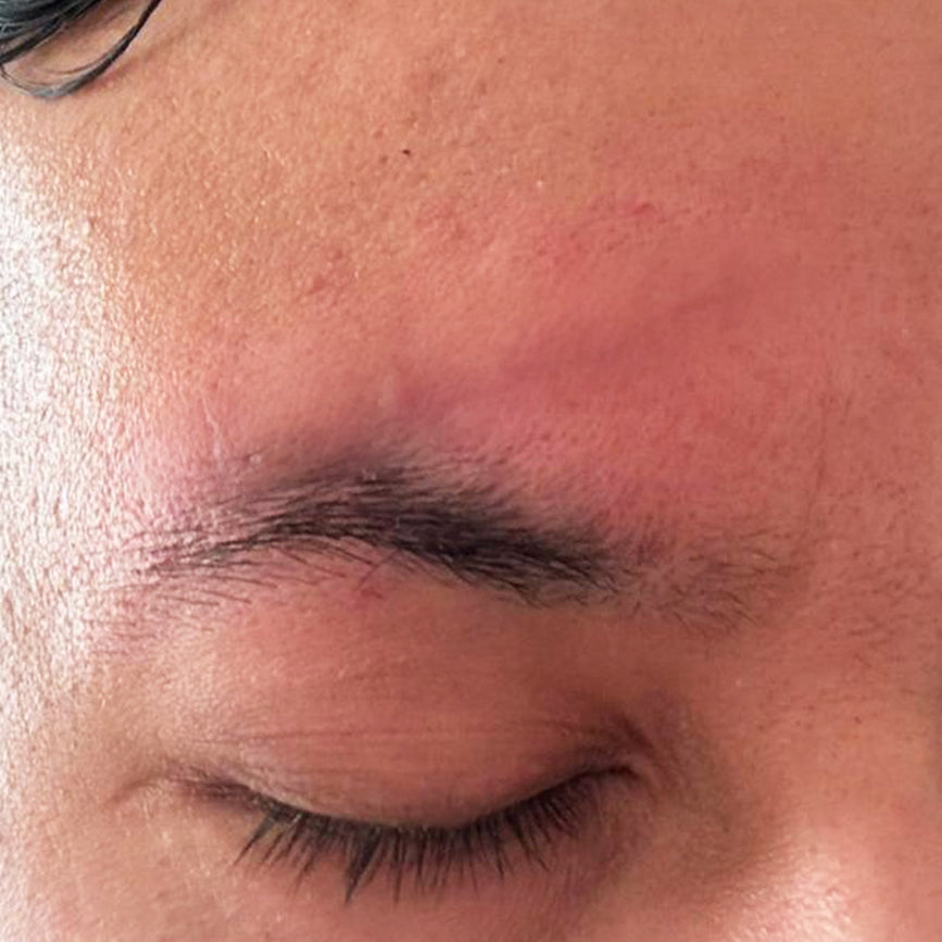 image comparison after