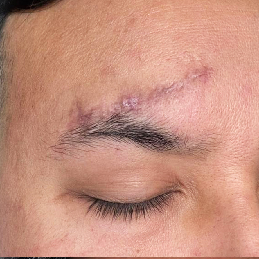 image comparison before