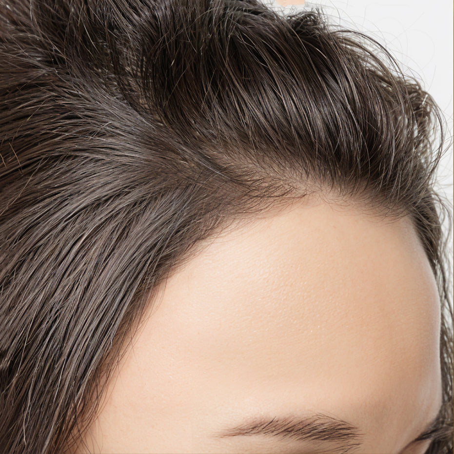 image comparison after